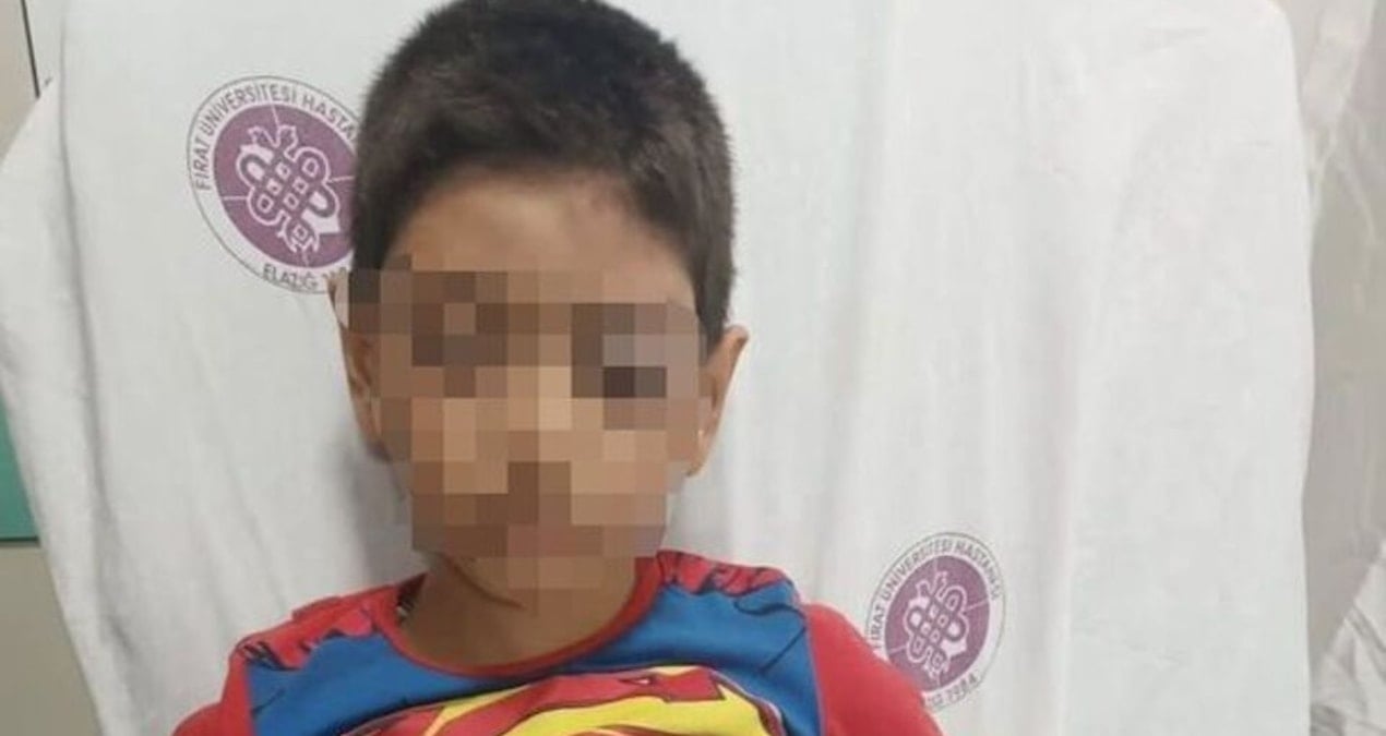 ogluyla tartisan cocuga fiziksel siddet uygulayan polis gorevinden uzaklastirildi u55Eh5JG