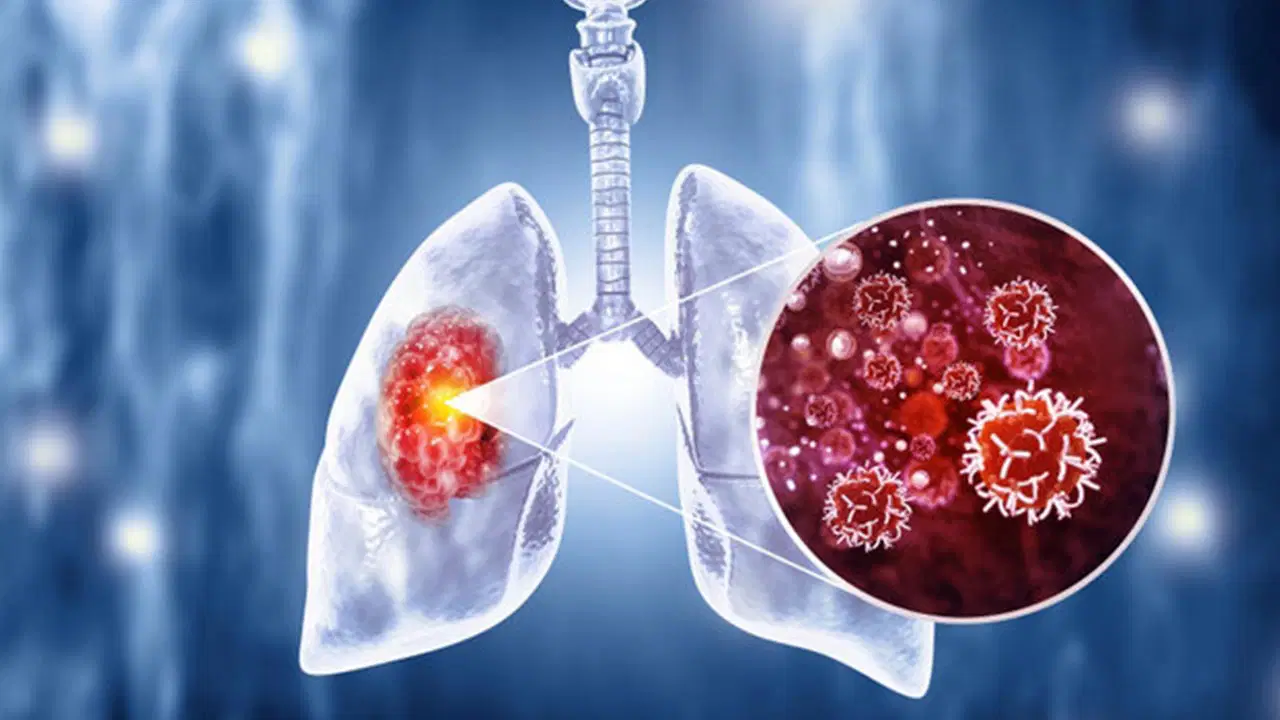 50 yasini asan sigara icicileri yilda bir taramadan gecmeli uyarisi 5qx5ewYN.jpg